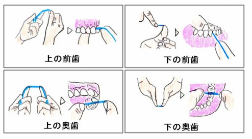 場所による磨き方の違い