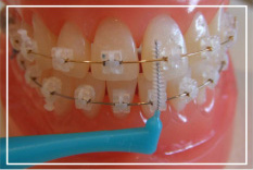 歯ブラシの基本