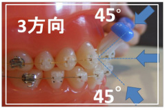 歯ブラシの基本